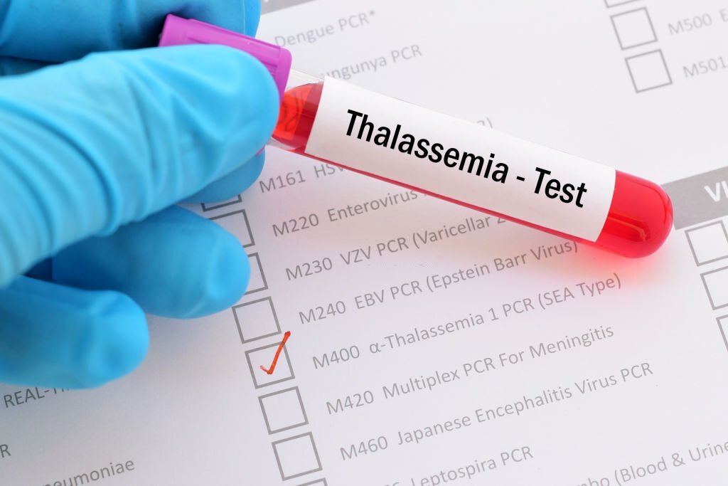 Blood sample with requisition form for thalassemia test
