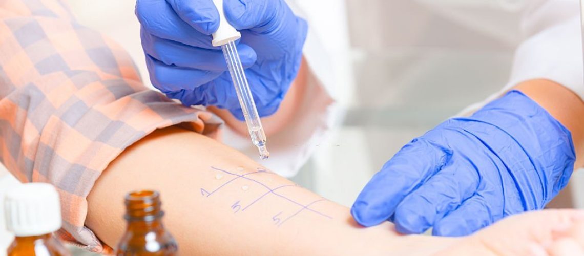 Medical doctor doing allergy tests in laboratory